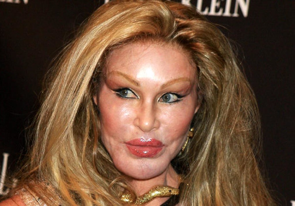 Jocelyn Wildenstein