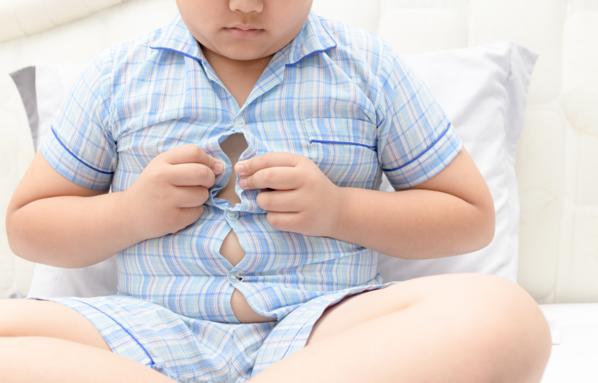 Obesidad infantil en Perú: Minsa revela que casi 150.000 niños menores de 5 años sufren de exceso de peso