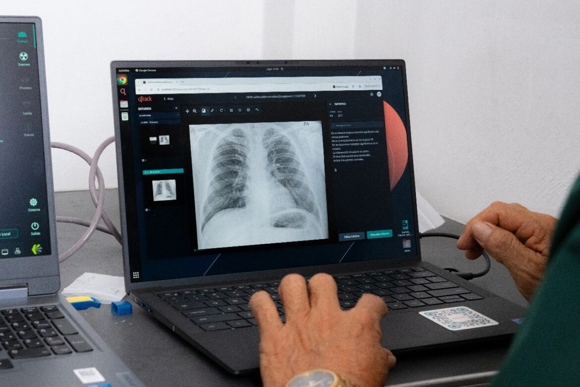 Minsa usa inteligencia artificial para detectar tuberculosis.