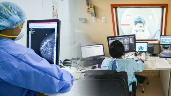 Minsa reportó más de 105 mil estudios de diagnóstico por imágenes en el Hospital Dos de Mayo. Foto: composición Caretas